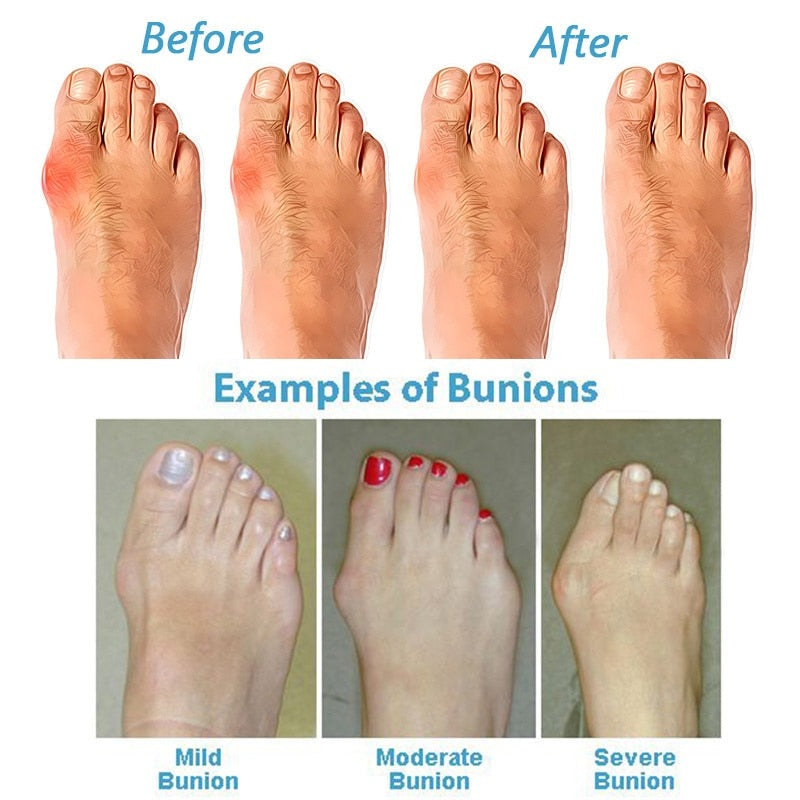 Comfortable Arch Support Sandals for Women with Cushioning