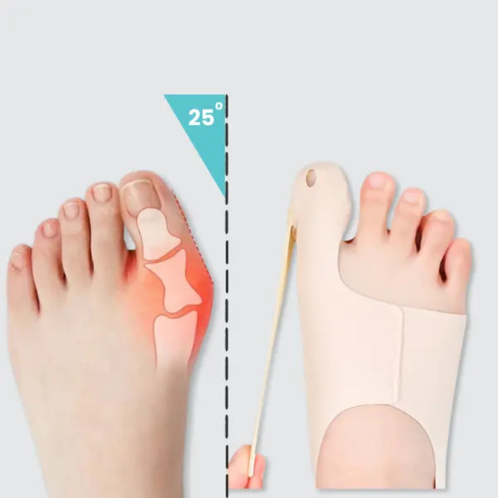 Bunion Corrector Sleeve